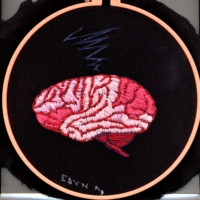 09EA2019Cranial Cranial